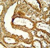 CCR1 Antibody (aa1-30)
