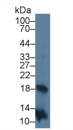 IL2 Antibody (aa21-153)