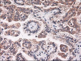 KRT18 / CK18 / Cytokeratin 18 Antibody (clone OTI5E8)