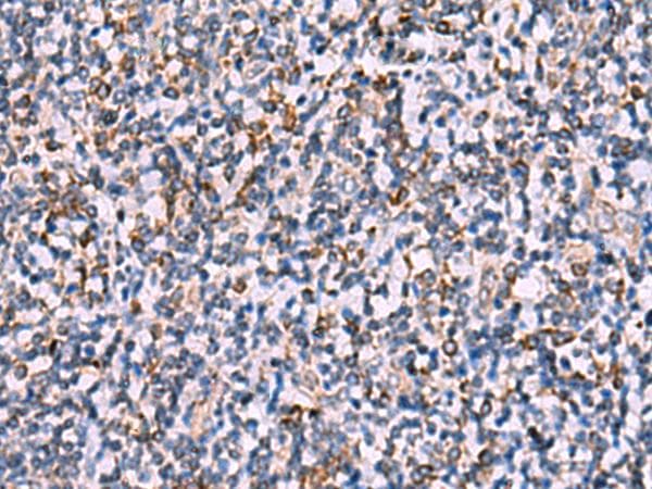 IPPK Antibody