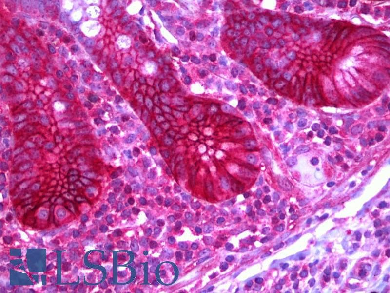 IHC-plus™ SLC12A2 / NKCC1 Antibody (clone 5H7)