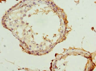 RTKN / Rhotekin Antibody