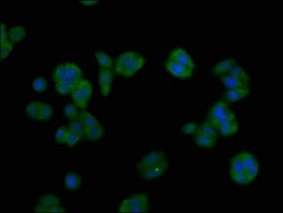 IHC-plus™ ASGR1 / ASGPR Antibody