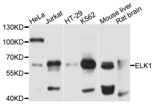 NBN / Nibrin Antibody