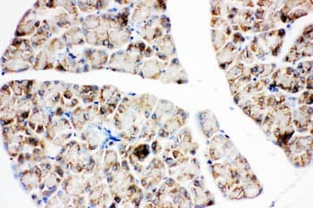 Polyclonal Rabbit anti-Human IGF1R / IGF1 Receptor Antibody (aa1353-1367, IHC, WB)