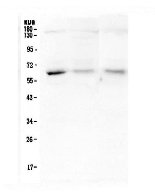 ARSA / Arylsulfatase A Antibody