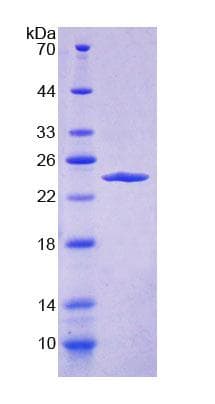 Human DMKN Protein (Recombinant His-T7)
