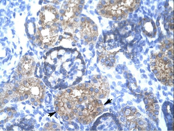 TRIM15 Antibody (aa141-190)