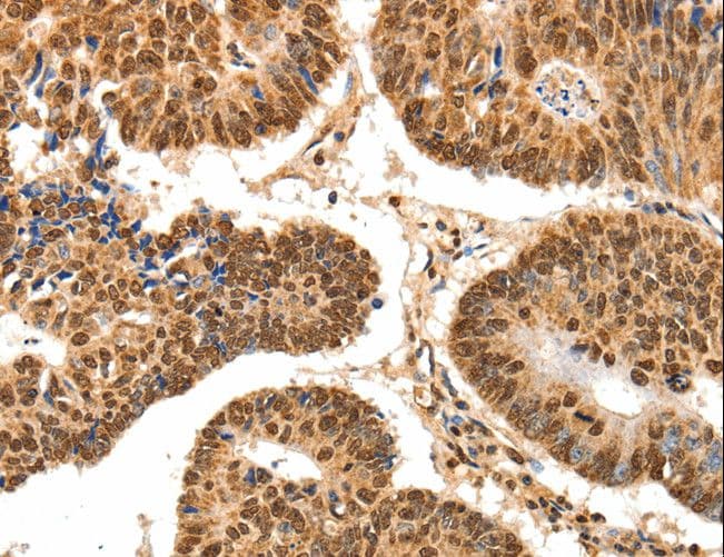 Polyclonal Rabbit anti-Human SPATA20 Antibody (IHC)