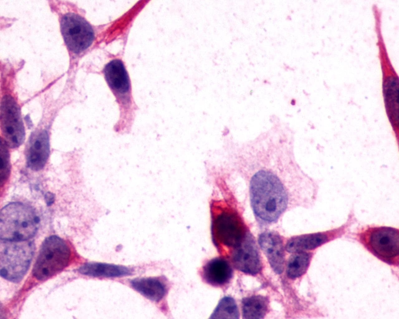 PathPlus™ GRM3 / MGLUR3 Antibody (N-Terminus)