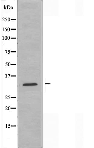 SPIN / SPIN1 Antibody
