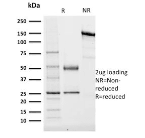 TCF4 Antibody (clone TCF4/1705)
