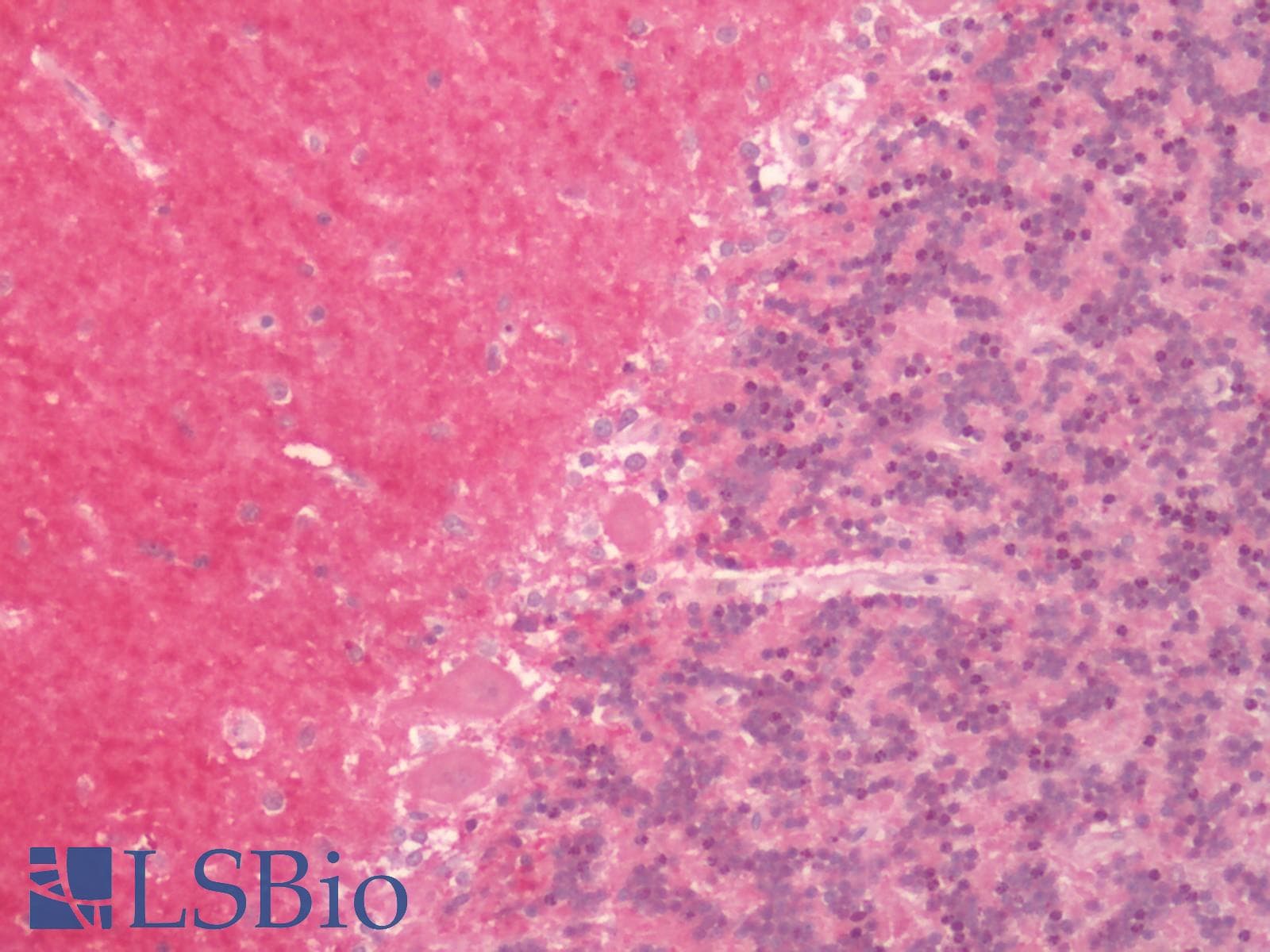 IHC-plus™ Polyclonal Rabbit anti-Human HTR1D / 5-HT1D Receptor Antibody (Cytoplasmic Domain, IHC)