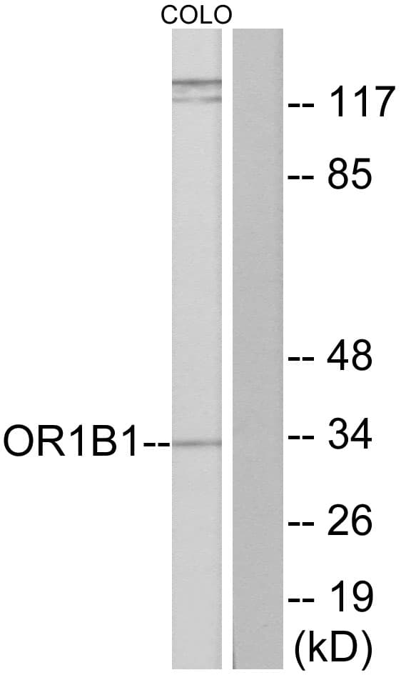 OR1B1 Antibody (aa161-210)