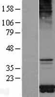 TOMM20 Protein (Over-Expression Lysate Myc-DDK (Flag))