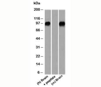 CTNNB1 / Beta Catenin Antibody