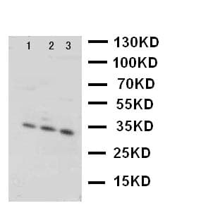 Polyclonal Rabbit anti-Human OSM / Oncostatin M Antibody (aa181-198, IHC, WB)
