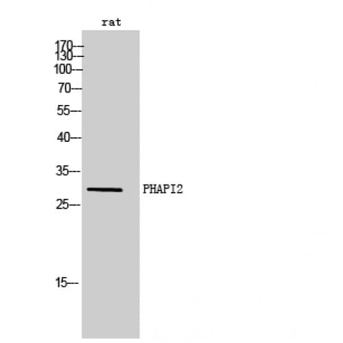ANP32B Antibody (10-90 aa, N-terminal)