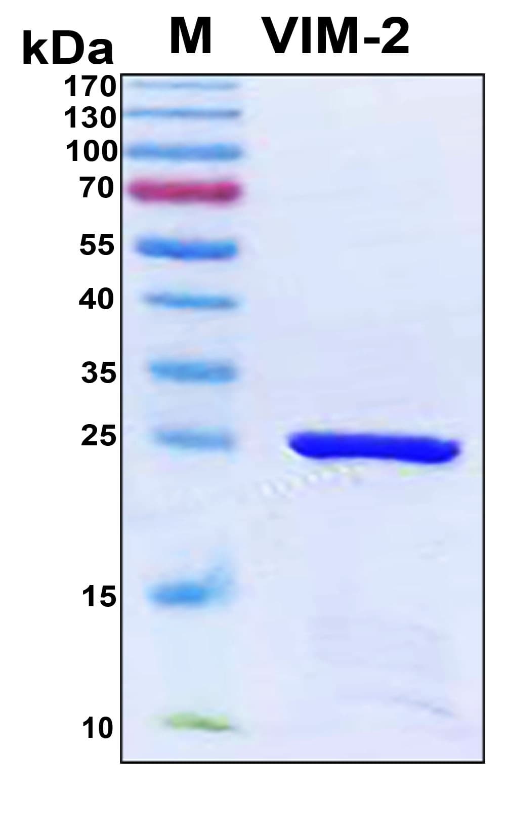 Pseudomonas aeruginosa Metallo-beta-lactamase VIM-2 Protein (Recombinant 6His, N-terminus)