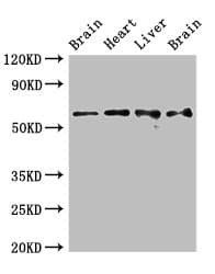 UBQLN1 / Ubiquilin Antibody