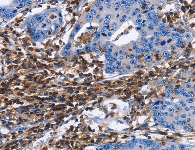 Polyclonal Rabbit anti-Human CD45 / LCA Antibody (IHC)