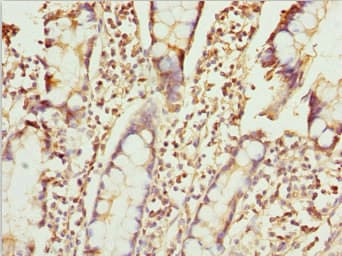 ZNF169 Antibody