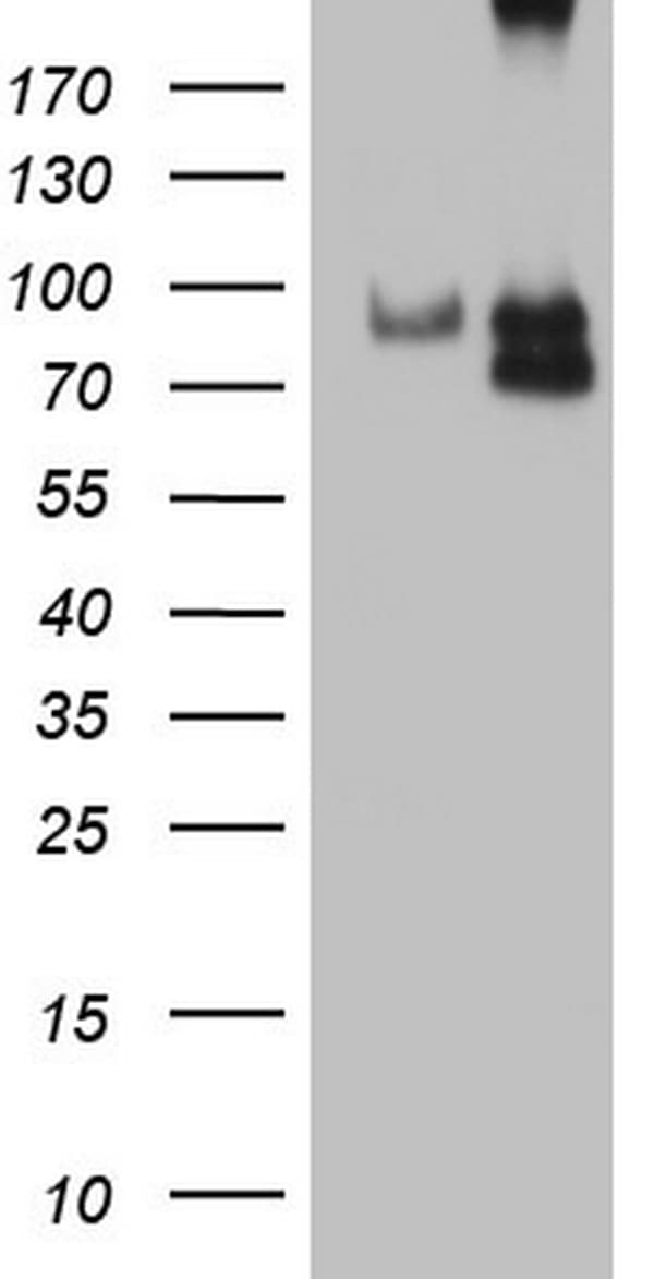 CFI / Complement Factor I Antibody (aa340-583, clone OTI6C1)