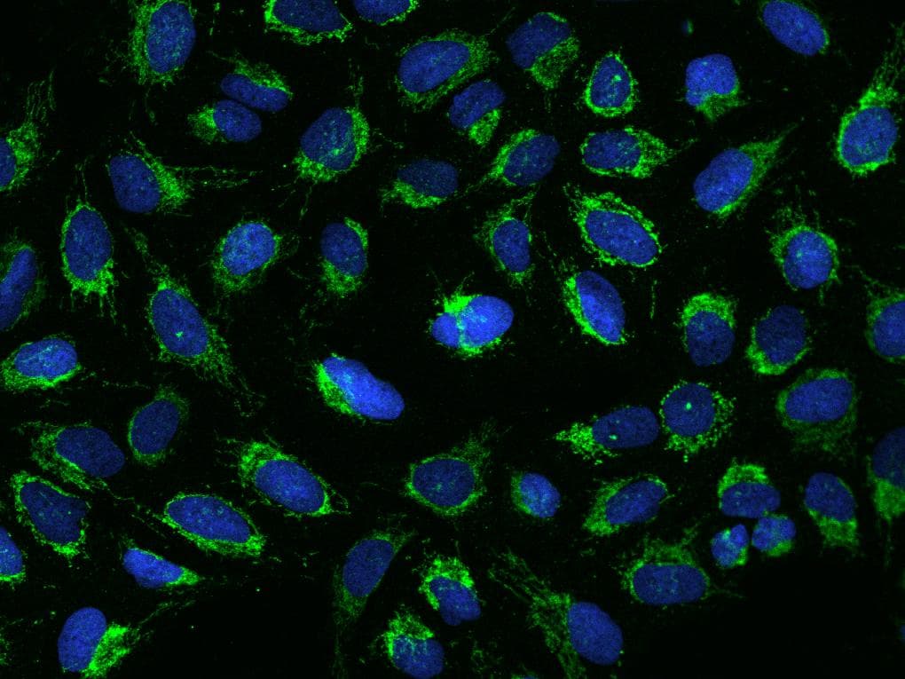 Polyclonal Rabbit anti-Human MRPS26 Antibody (IHC, IF, WB)