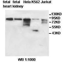 Polyclonal Rabbit anti-Human IMMT / Mitofilin Antibody (aa382-634, IHC, WB)