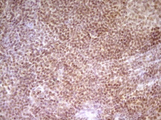 NR2C2 / TAK1 Antibody (aa1-241, clone OTI1F3)