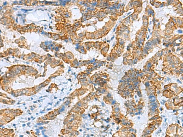 FBXO8 / FBX8 Antibody