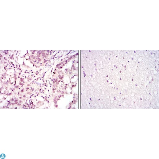 ATF2 Antibody