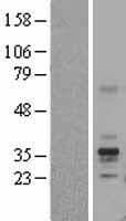 FOLR1 / Folate Receptor Alpha Protein (Over-Expression Lysate Myc-DDK (Flag))