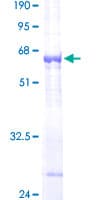 Human CTSO Protein (Recombinant GST)