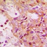 RPS13 / Ribosomal Protein S13 Antibody (Internal)