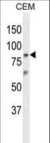 ZNF160 Antibody (aa143-171)