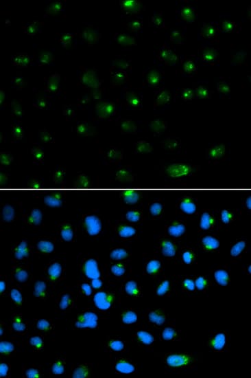 Polyclonal Rabbit anti-Human PSAP / Prosaposin Antibody (IHC, IF, WB)