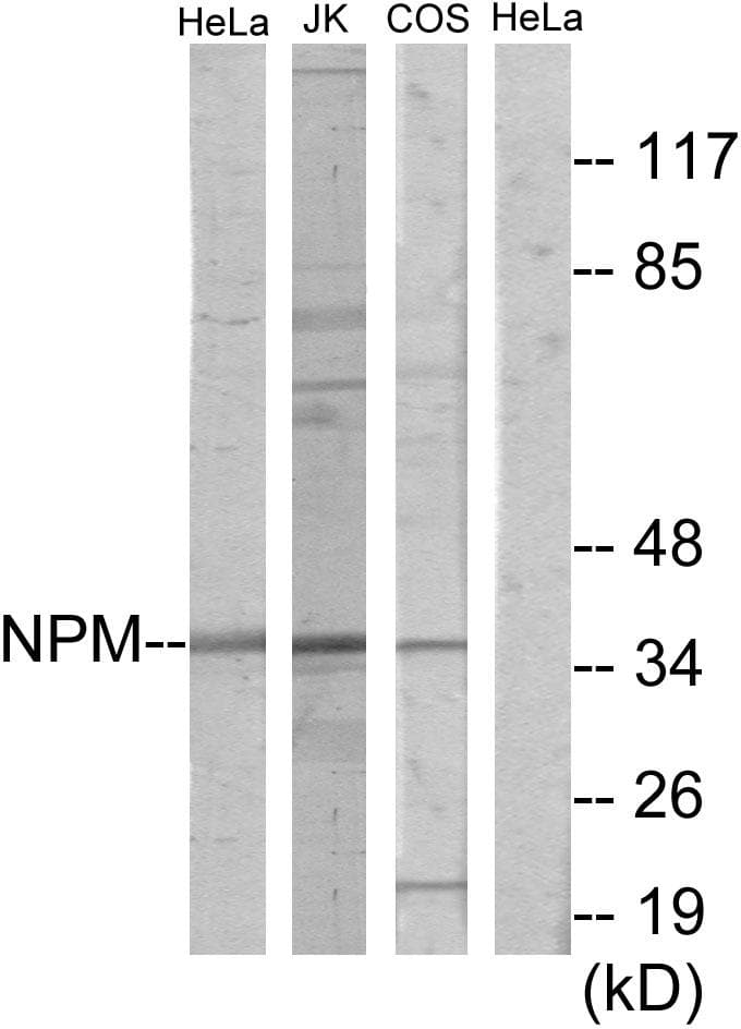 NPM1 / NPM / Nucleophosmin Antibody
