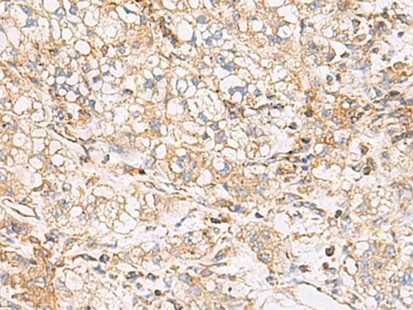 FYCO1 Antibody