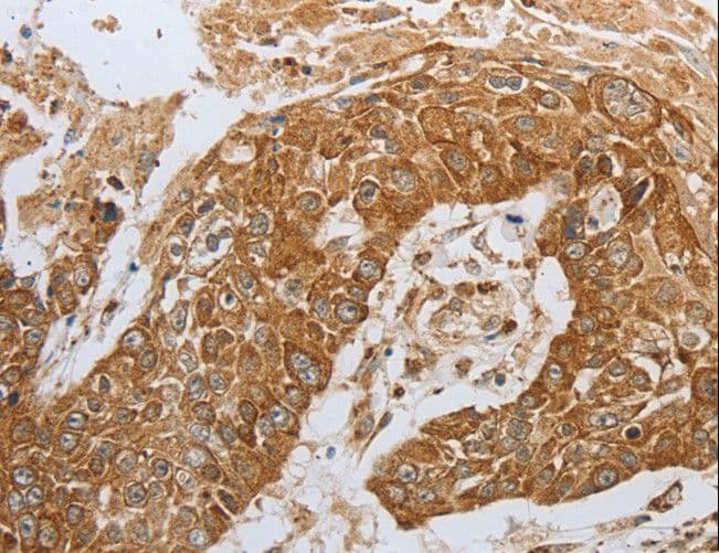 CKM / Creatine Kinase MM Antibody
