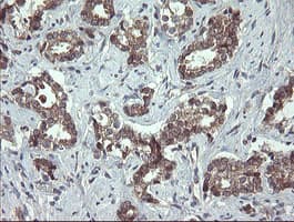 UBE2J1 Antibody (clone OTI1C7)