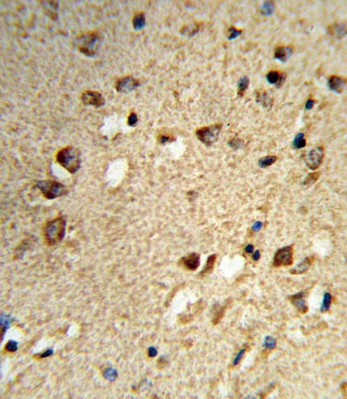 NCOA7 Antibody (aa76-103)