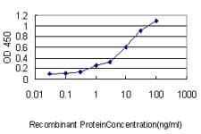 ZNF143 / STAF Antibody (clone 2B4)