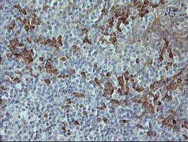 MAPK9 / JNK2 Antibody (clone OTI4D1)