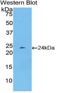 PTX3 / Pentraxin 3 Antibody (aa195-381)