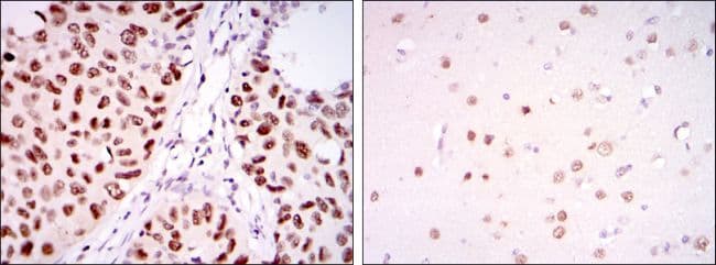 PSIP1 / LEDGF Antibody (clone 60000)