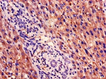 PSMB5 Antibody