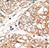 Polyclonal Rabbit anti-Human BOK Antibody (aa60-90, IHC, WB)