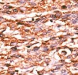 Polyclonal Rabbit anti-Human KDR / VEGFR2 / FLK1 Antibody (phospho-Tyr996, IHC, WB)