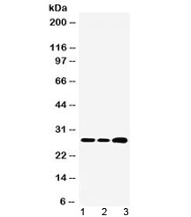 Polyclonal Rabbit anti-Human RPL19 / Ribosomal Protein L19 Antibody (WB)